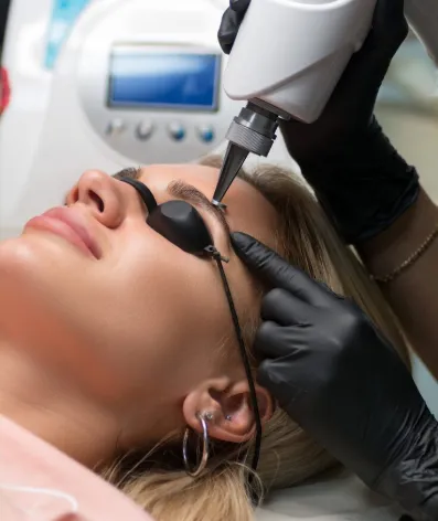 Despigmentação a Laser