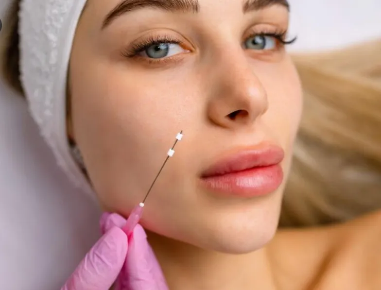 Fios de Sustentação